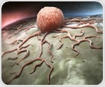 Myeloid cells shape tumor microenvironments and influence cancer progression